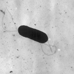 Electron micrograph of a flagellated Listeria monocytogenes bacterium, Magnified 41,250 times. Listeria monocytogenes is the infectious agent responsible for the food borne illness Listeriosis. 