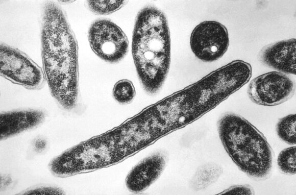 This 1978 electron microscope image made available by the Centers for Disease Control and Prevention shows Legionella pneumophila bacteria which are responsible for causing the pneumonic disease Legionnaires' disease. In a report released Wednesday, Aug. 14, 2019, the National Academies of Sciences, Engineering and Medicine said annual cases of Legionnaires’ jumped more than fivefold from 2000 to 2017, and that as many as 70,000 Americans get the disease every year. High-profile recent outbreaks occurred in Atlanta and Flint, Michigan. (Francis Chandler/CDC via AP)